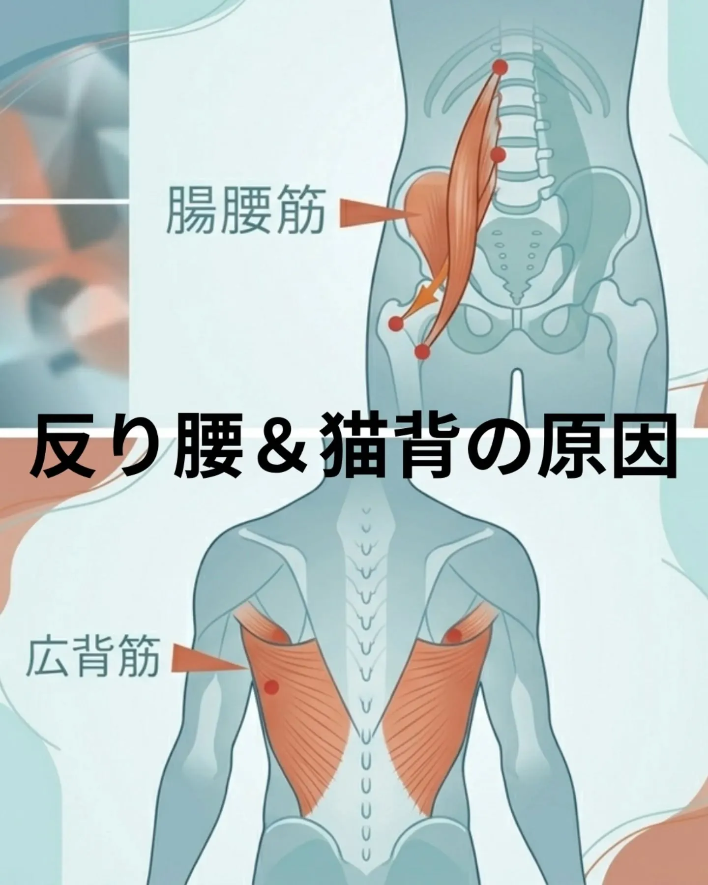 腰痛の根本原因は、、、筋肉の不均衡による姿勢不良かも！
