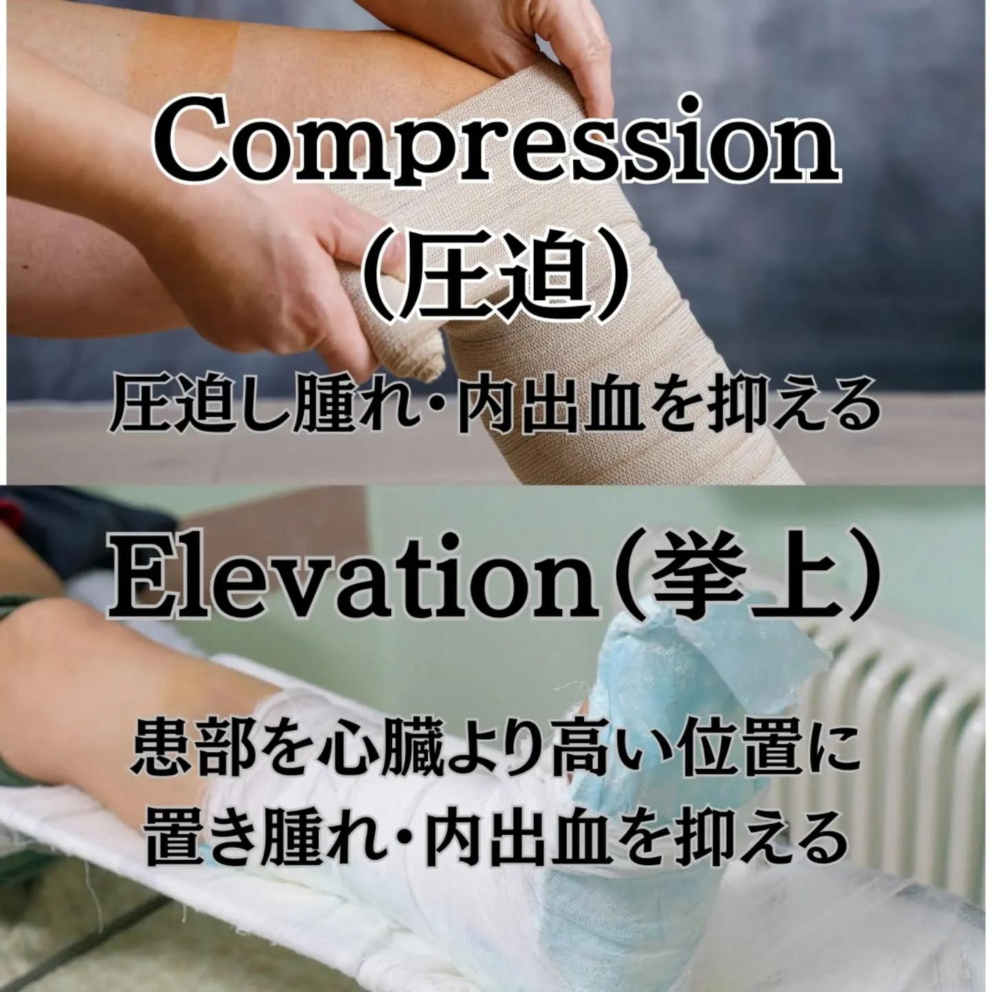 【ケガの鉄則】回復を早める「RICE処置」の基本