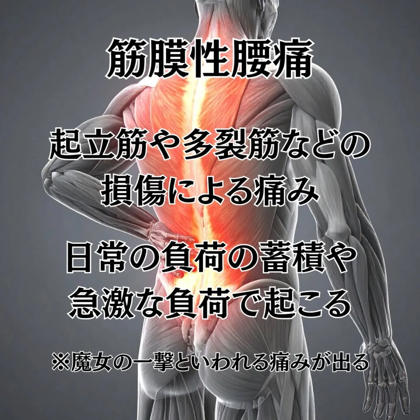 【急性腰痛（ギックリ腰）の臨床的分類】
