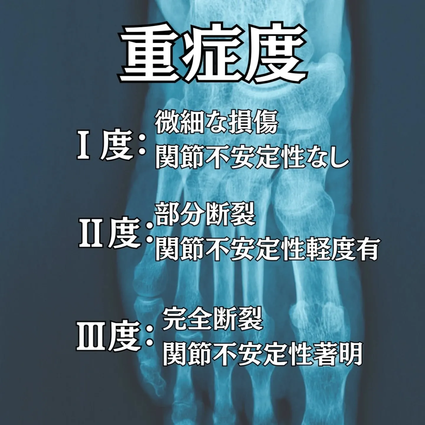 捻挫は「単なる痛み」ではなく、関節安定機構の構造的破綻です。