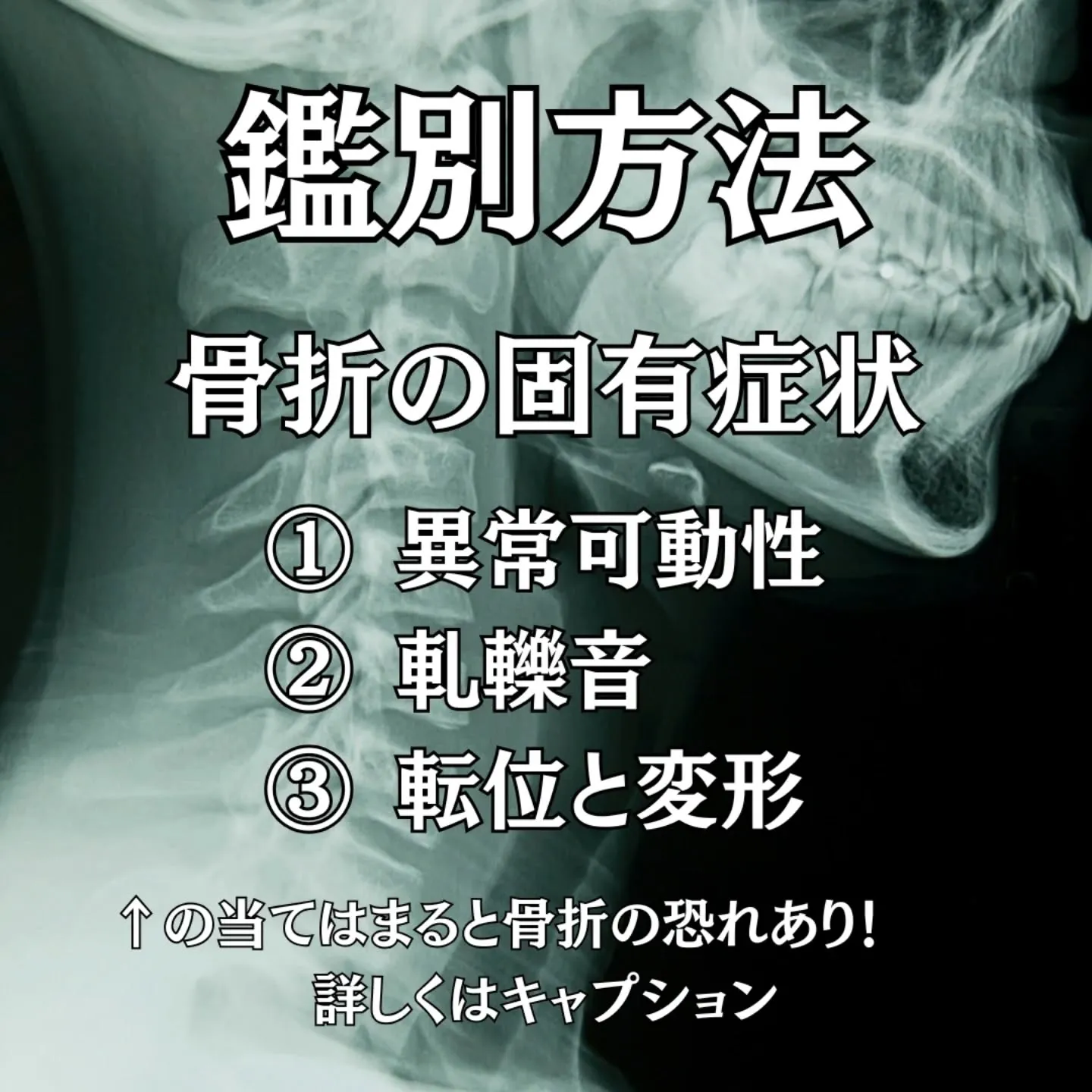 骨折は早期の正確な評価と適切な固定が、その後の機能回復を大き...