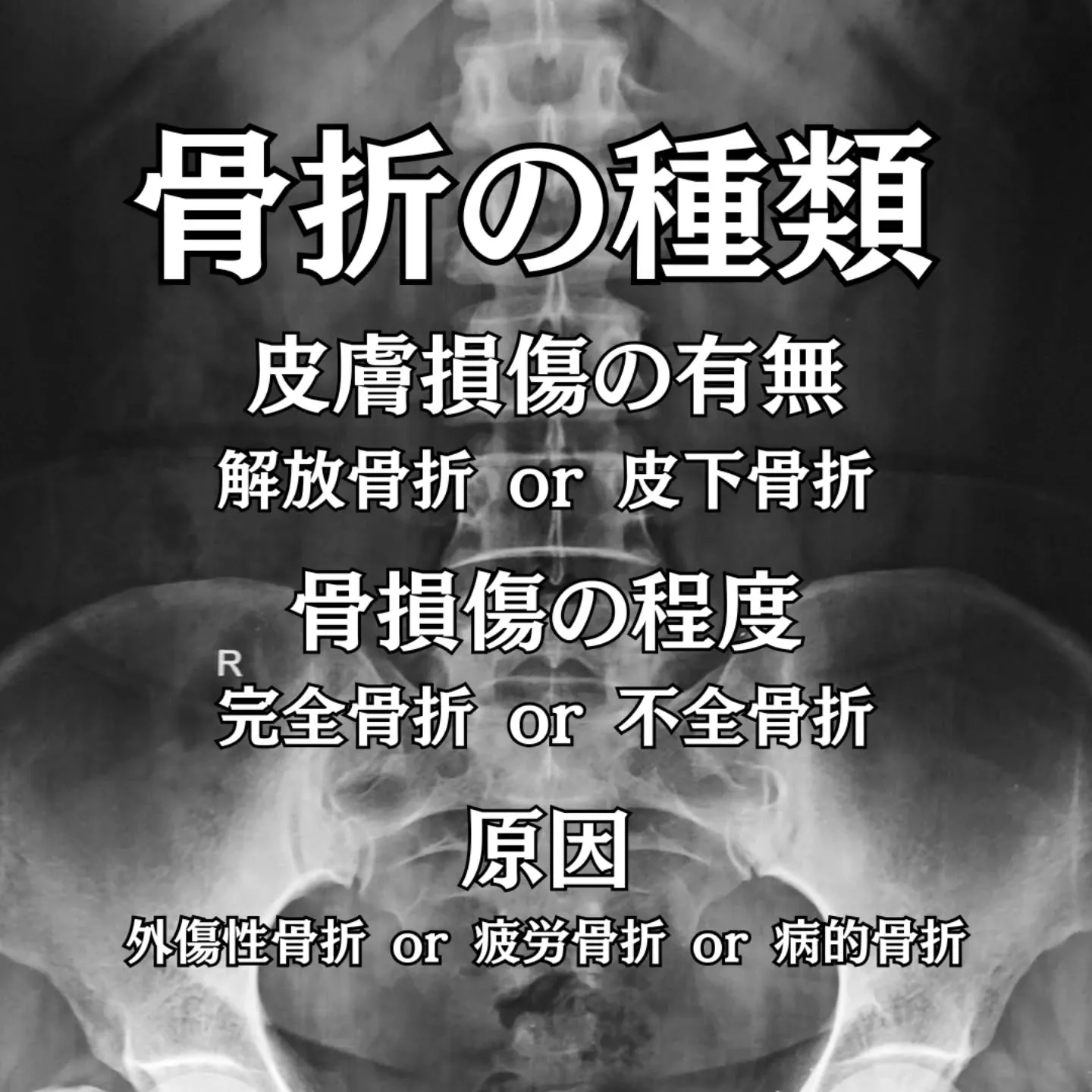 骨折は早期の正確な評価と適切な固定が、その後の機能回復を大き...