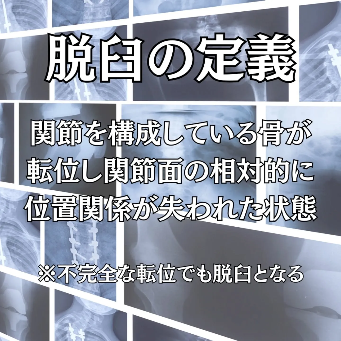 「肩が外れた」「指を脱臼した」