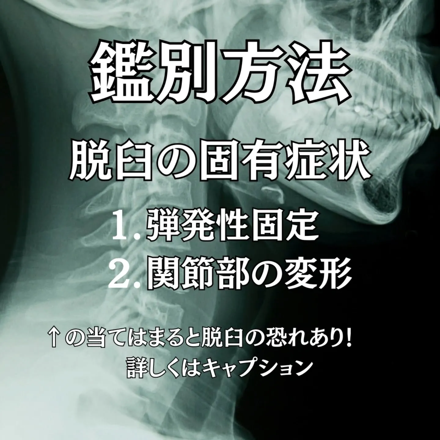 「肩が外れた」「指を脱臼した」