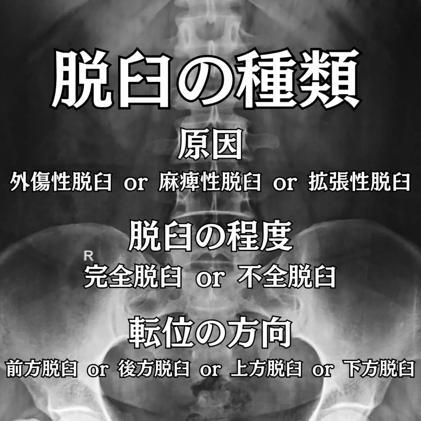 「肩が外れた」「指を脱臼した」