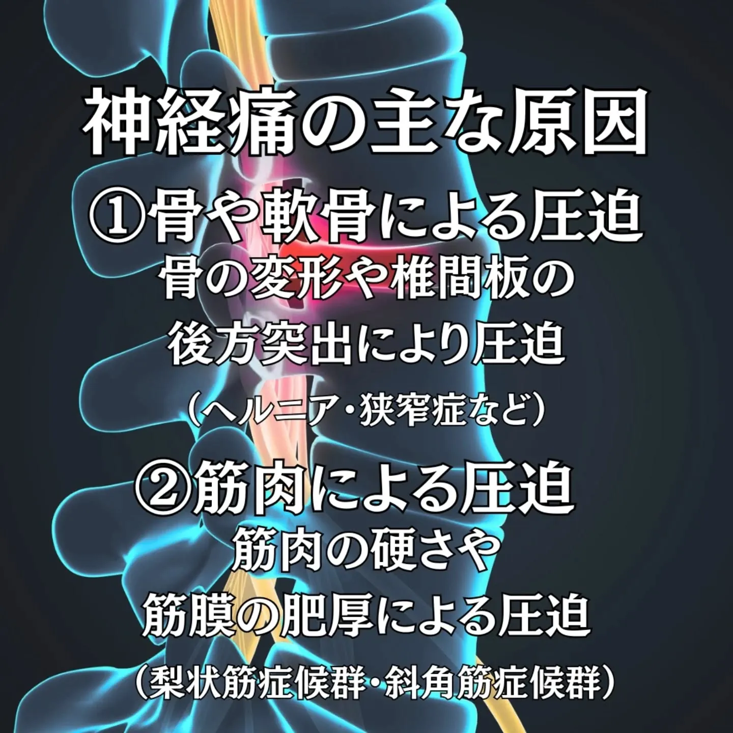 【神経痛とは？その正体を正しく知る】