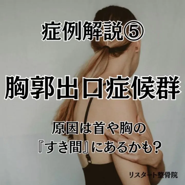 【症例紹介⑤ 胸郭出口症候群：腕のしびれや手のピリピリ感、原...