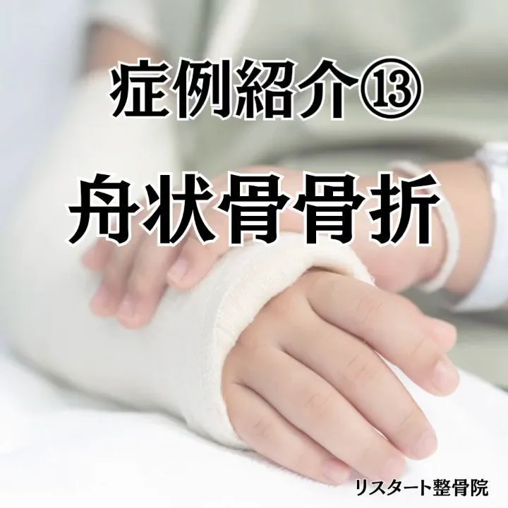 ​私が最も遭遇したくない骨折【舟状骨骨折（しゅうじょうこつこ...