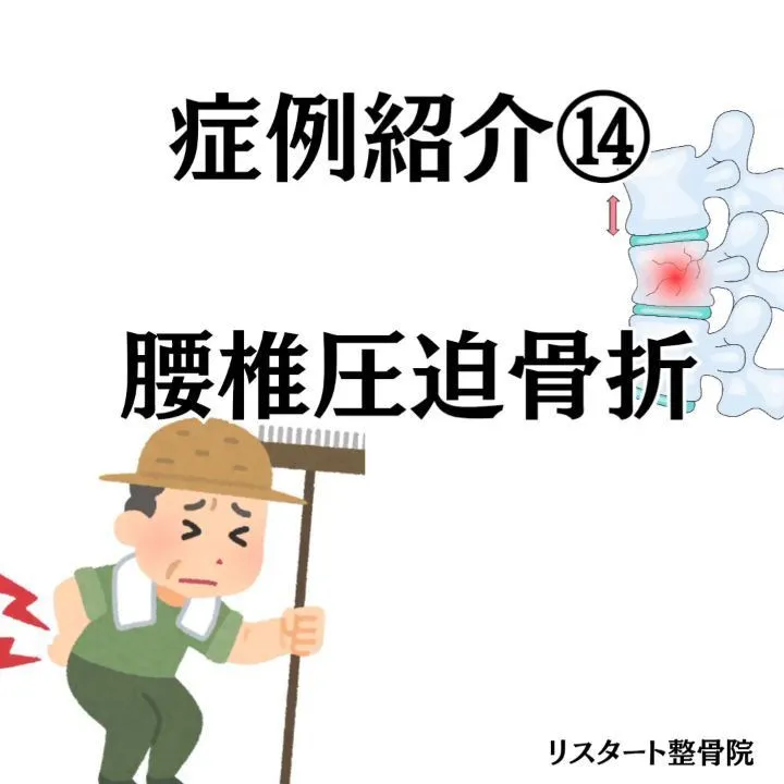 今回のテーマは「腰椎圧迫骨折」です。