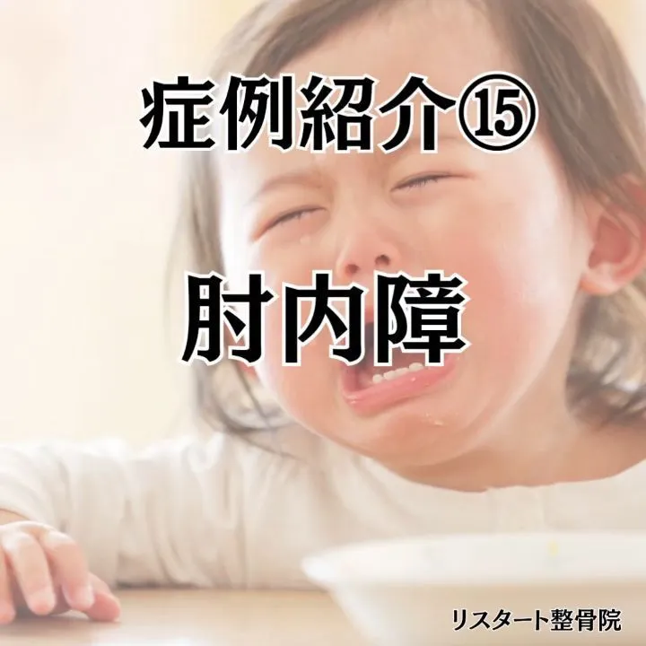 子どもの急なケガで多い 肘内障（ちゅうないしょう）について解...